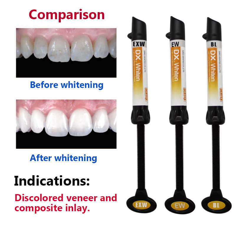 Resin Komposit Gigi Enamel Lig - Lighting Jockey ulasan dan harga