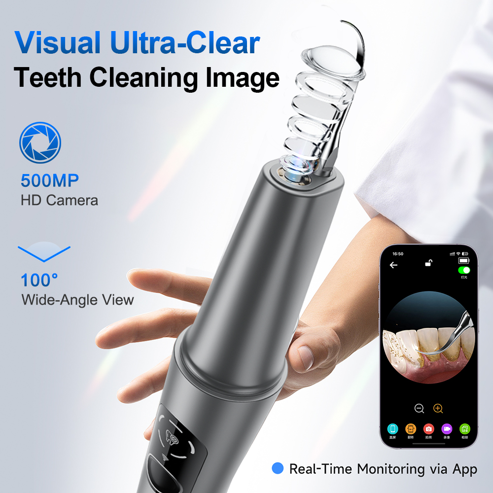 Alat Pembersih Karang Gigi Ult - Lighting Visual ulasan dan harga